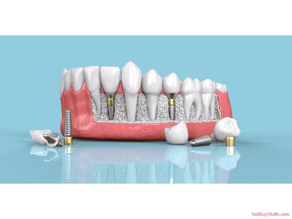 Mumbai Cost of Tooth Implants in India