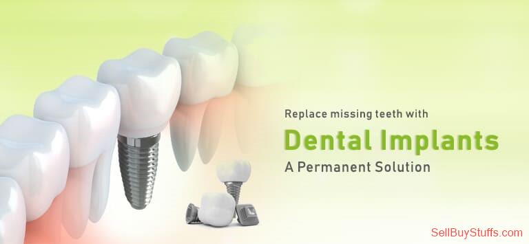 Mumbai Dental Implants in India